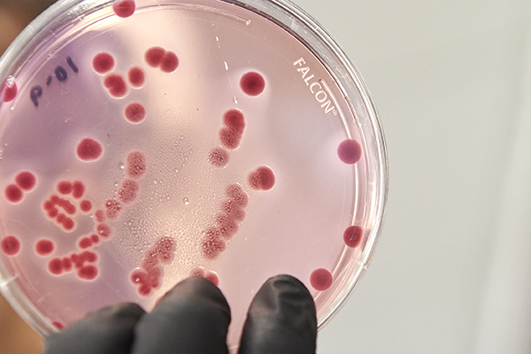 Cell Colony, Cell Count, Cell Counting, Cell Tracker